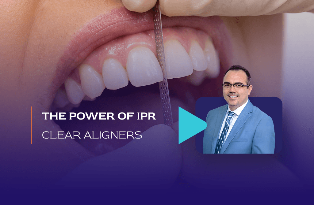 Unleash the power of interproximal reduction (ipr) with clear aligners