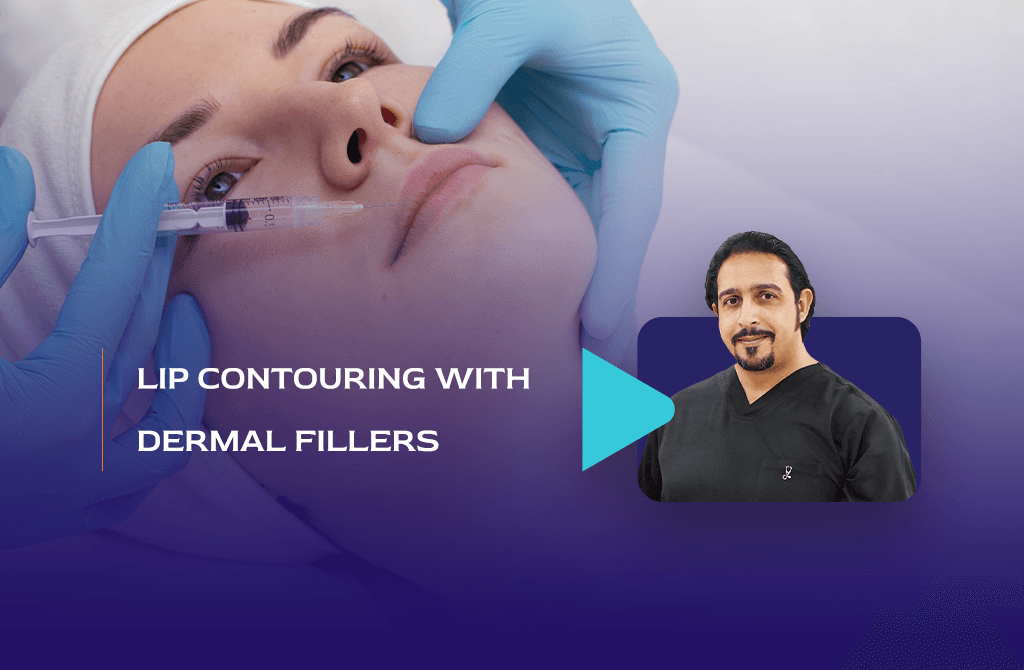 Lip Contouring With Dermal Fillers