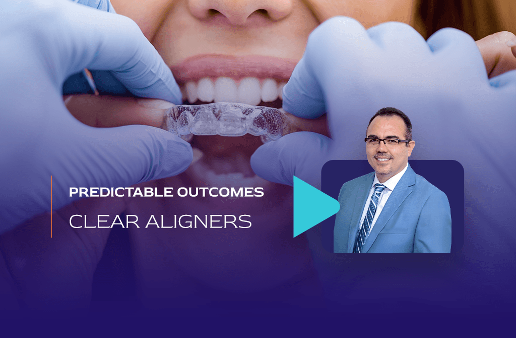 Clinical Pearls for Predictable Outcomes with Clear Aligners