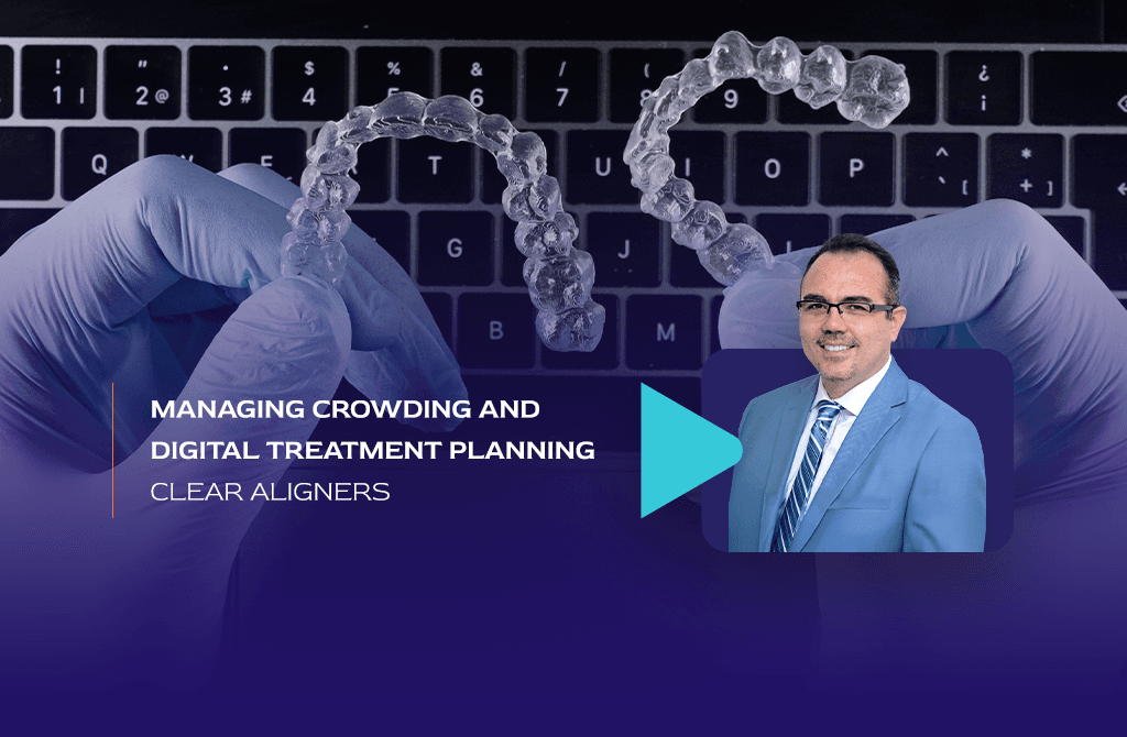 Streamlining Success: Managing Crowding with Clear Aligners and Digital Treatment Planning