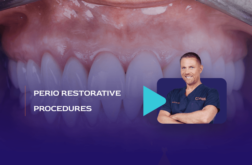 Perio Restorative Procedures For Daily Practice