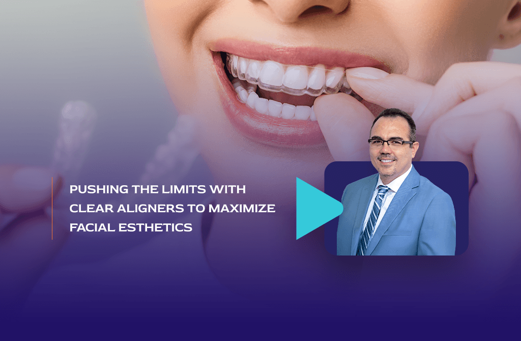 Pushing the Limits with Clear Aligners to Maximize Facial Esthetics