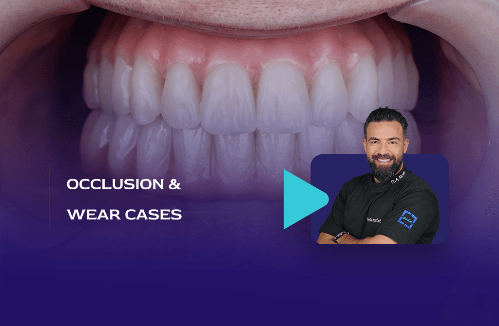 Occlusion & Wear Cases
